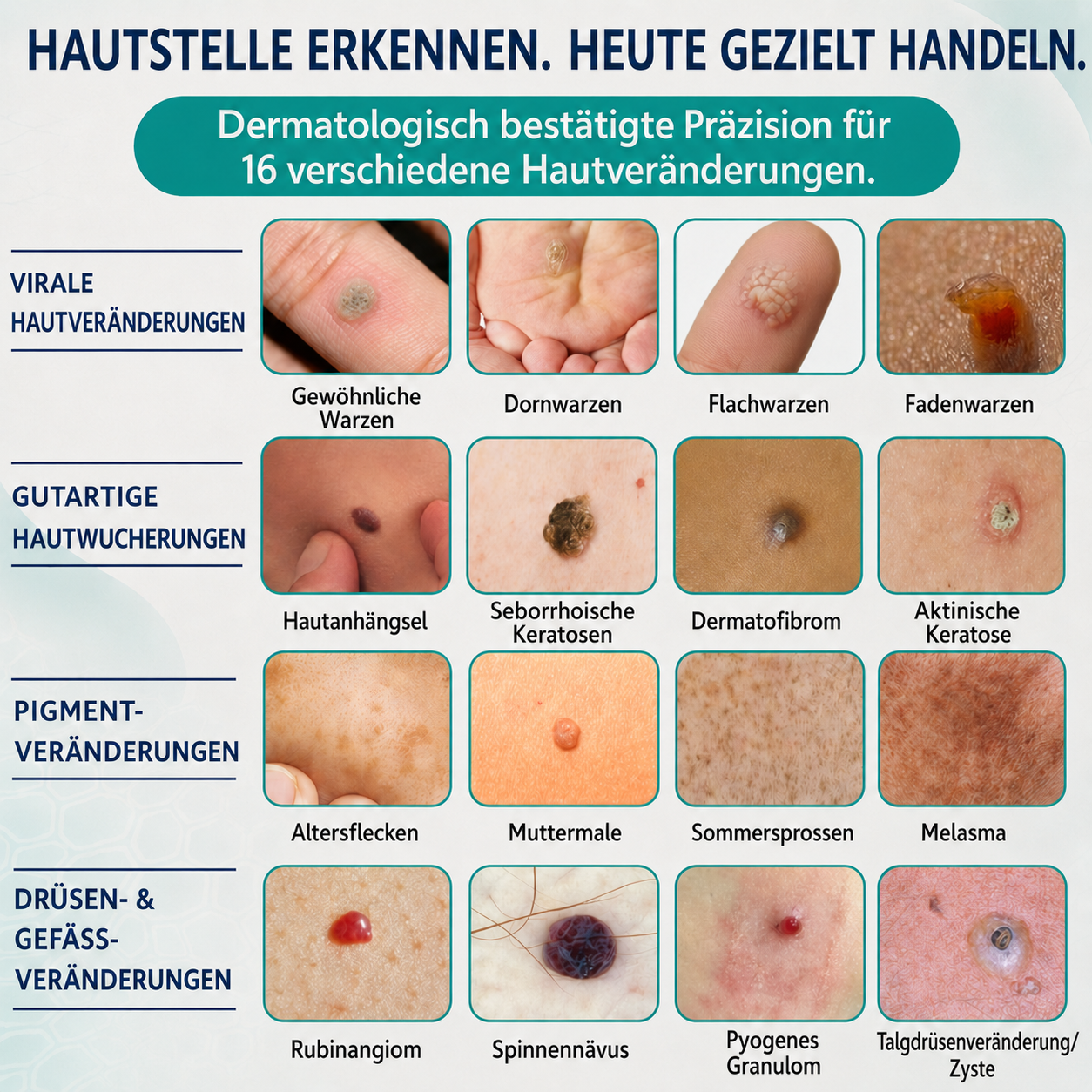 🇩🇪✨🌿 Celsiora® 7-Tage Warzen- & Hautanhängsel-Entfernungsschaum (Gezielte Pflege bei Warzen, Hautanhängseln & unebenem Hautbild)