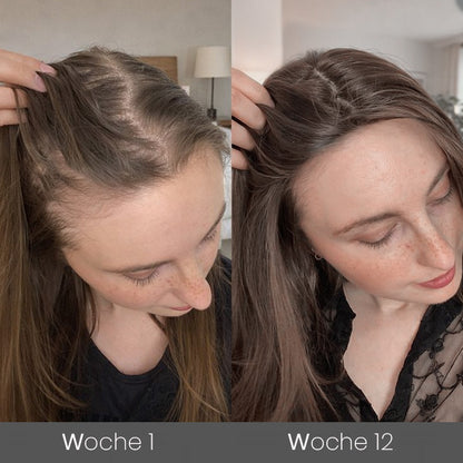 ✅👨‍⚕️Offizieller Store 🇩🇪 | 🔥Rolimey® Hochwirksames Biotin & Rosmarin Haarwachstumsserum– Füllt lichte Stellen & Geheimratsecken sichtbar auf (🔥Zeitlich begrenzter Rabatt, ⏳letzte 30 Minuten)