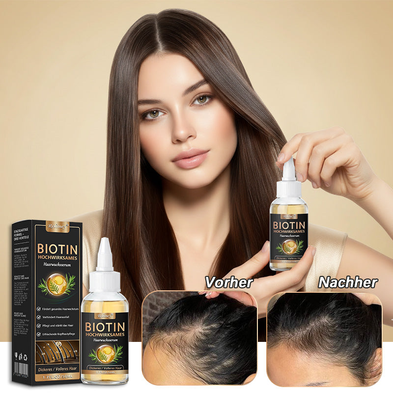 ✅👨‍⚕️Offizieller Store 🇩🇪 | 🔥Rolimey® Hochwirksames Biotin & Rosmarin Haarwachstumsserum– Füllt lichte Stellen & Geheimratsecken sichtbar auf (🔥Zeitlich begrenzter Rabatt, ⏳letzte 30 Minuten)