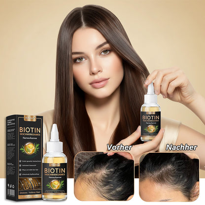 ✅👨‍⚕️Offizieller Store 🇩🇪 | 🔥Rolimey® Hochwirksames Biotin & Rosmarin Haarwachstumsserum– Füllt lichte Stellen & Geheimratsecken sichtbar auf (🔥Zeitlich begrenzter Rabatt, ⏳letzte 30 Minuten)
