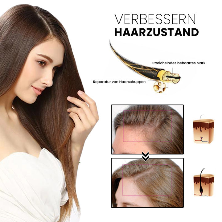 ✅👨‍⚕️Offizieller Store 🇩🇪 | 🔥Rolimey® Hochwirksames Biotin & Rosmarin Haarwachstumsserum– Füllt lichte Stellen & Geheimratsecken sichtbar auf (🔥Zeitlich begrenzter Rabatt, ⏳letzte 30 Minuten)