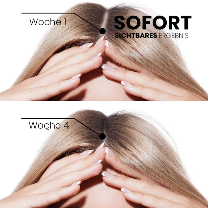 ✅👨‍⚕️Offizieller Store 🇩🇪 | 🔥Rolimey® Hochwirksames Biotin & Rosmarin Haarwachstumsserum– Füllt lichte Stellen & Geheimratsecken sichtbar auf (🔥Zeitlich begrenzter Rabatt, ⏳letzte 30 Minuten)