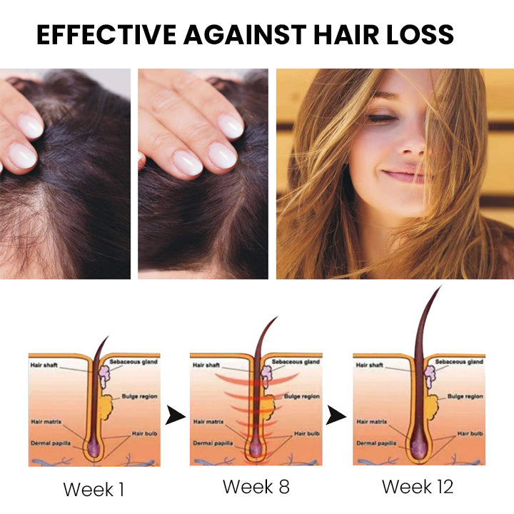 ✅👨‍⚕️Offizieller Store 🇩🇪 | 🔥Rolimey® Hochwirksames Biotin & Rosmarin Haarwachstumsserum– Füllt lichte Stellen & Geheimratsecken sichtbar auf (🔥Zeitlich begrenzter Rabatt, ⏳letzte 30 Minuten)